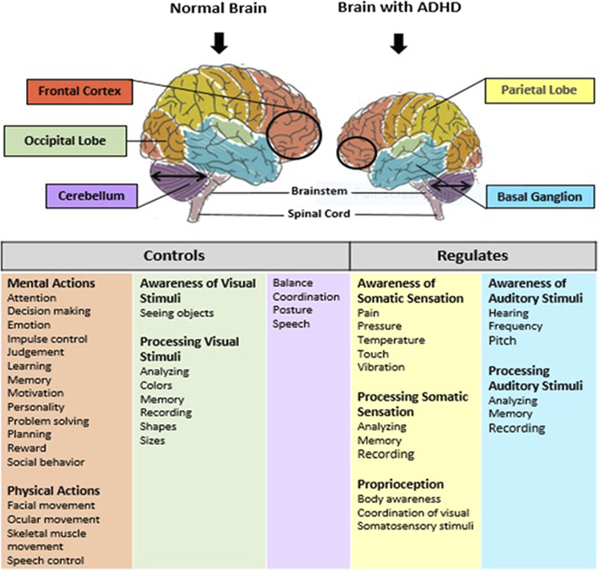 Normal and ADHD Brain