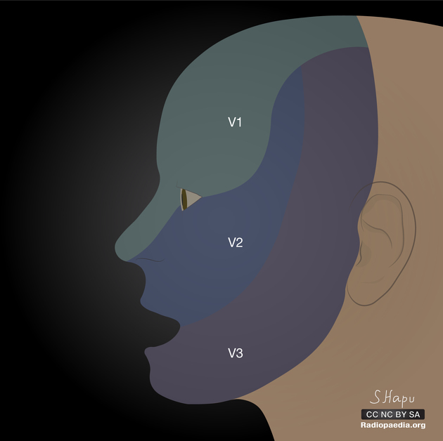 Trigeminal nerve diagram
