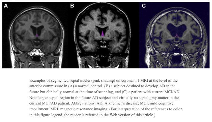 Septal nuclei diagram