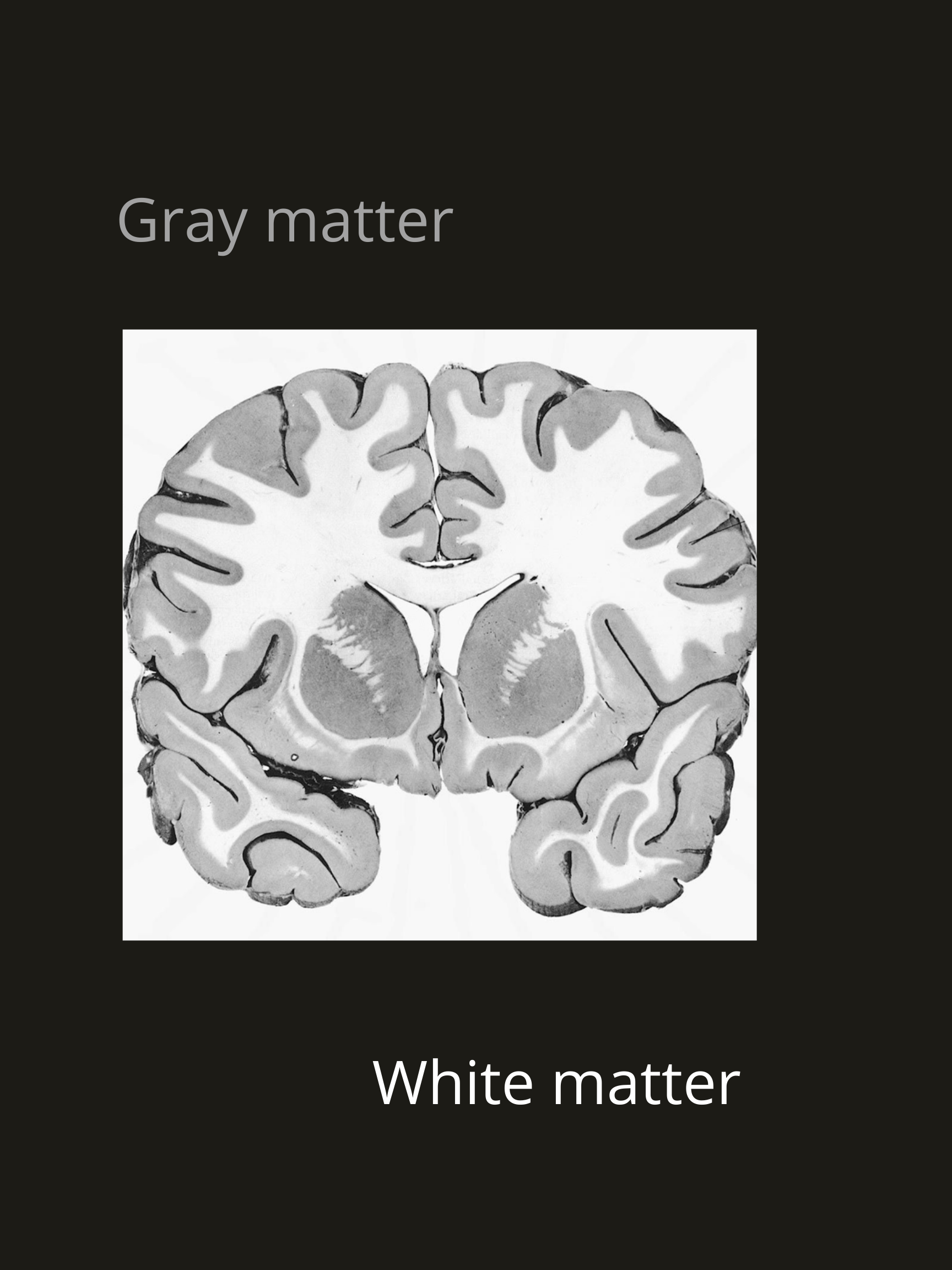 White and gray matter brain