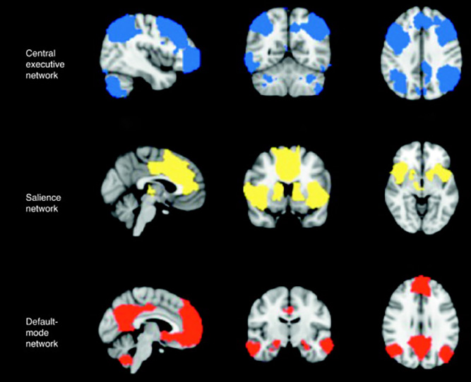 Triple Network Model 2